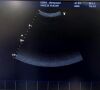 GE VIVID I Ultrasound