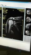 ESAOTE S-scan MRI Scanner