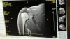 ESAOTE S-scan MRI Scanner
