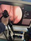 FUJINON EN-580T Gastroscope