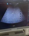 SAMSUNG Probe 10-2Samsung Medison H60 Convex Array Original Ultrasound Probe CF2-8