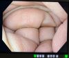 OLYMPUS GIF-HQ190 Gastroscope