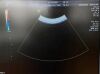 GE HEALTHCARE Probe GE Logiq S7 Convex Array Original Ultrasound Transducer Probe C1-5-D
