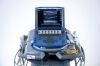 SONOSITE/MICROMAXX P06468-10 USG Machine