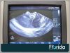 PHILIPS 3D9-3V ENDOCAVITARY TRANSDUCER PROBE REF 453561222119 TESTED 30 DAYS WARRANTY Ultrasound Transducer