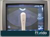 PHILIPS 3D9-3V ENDOCAVITARY TRANSDUCER PROBE REF 453561222119 TESTED 30 DAYS WARRANTY Ultrasound Transducer