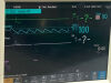 PHILIPS MEDICAL 862442 M3001A MODULE OPT  A01C06