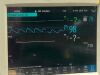 PHILIPS MEDICAL 862442 M3001A MODULE OPT  A01C06