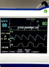 ZOLL R-Series Defibrillator