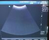 GE Vivid 3 Ultrasound - Cardiac - Vascular