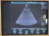 GE Vivid 3 Ultrasound - Cardiac - Vascular