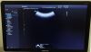 SAMSUNG CA1-7A Ultrasound Transducer