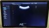 SAMSUNG CA1-7A Ultrasound Transducer