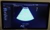 SAMSUNG CA1-7A Ultrasound Transducer
