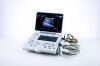 ESAOTE MyLab Alpha 7400 USG Machine