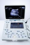 ESAOTE MyLab Alpha 7400 USG Machine