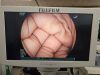 FUJINON EG530D Gastroscope