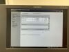 SIEMENS X300 PE Ultrasound - Shared Service