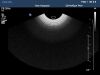 PHILIPS C8-4V Ultrasound Transducer