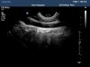 PHILIPS C8-4V Ultrasound Transducer