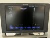 SIEMENS X300 PE Ultrasound - OB / GYN