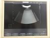 SAMSUNG Accuvix V10 Ultrasound - Cardiac - Vascular