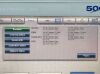 FRESENIUS 5008S YOM: 2012 Dialysis Machine