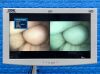 KARL STORZ Scope Model: 13821 PKS Laparoscope