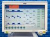 DRAEGER Dräger Evita Infinity V500 Ventilator  YOM: 2014 Ventilator