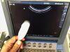 SONOSITE C11E Ultrasound Transducer