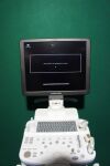KONICA MINOLTA SONIMAGE 613 ultrasound