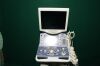ALOKA Prosound a7 ultrasound