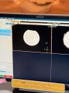 PHILIPS Achieva 1.5T MRI Scanner