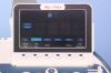 ESAOTE MyLabTwice HD Ultrasound Machine