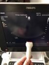 PHILIPS S4-2 Ultrasound Transducer