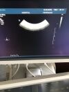 PHILIPS C8-5 Ultrasound Transducer