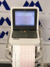 PHILIPS PageWriter TC50 EKG
