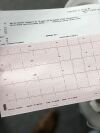 PHILIPS PageWriter TC50 EKG