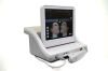 ULTHERA Ultherapy Laser - Radio Frequency (RF)