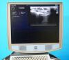 ZONARE Z.One Ultra Convertible Ultrasound