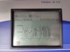 BERTHOLD TECHNOLOGIES LB 513 Radiation Meter