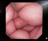 OLYMPUS GIF-XP170N Endoscope
