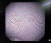 OLYMPUS GIF-XP170N Endoscope