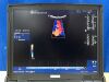GE Logiq E YOM: 2012 Probe  4C-RS YOM: 2017 Ultrasound