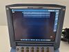 SONOSITE Micromaxx Ultrasound - Shared Service