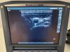 SONOSITE Micromaxx Ultrasound - Shared Service