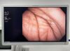 OLYMPUS Scope GIF-1TH190 Endoscope