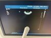 PHILIPS iU22 Ultrasound System