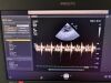PHILIPS Affinity 70C Ultrasound - Cardiac - Vascular