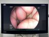 FUJINON Scope Model: EC-600WL Endoscopy Processor